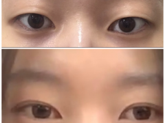 셀카후기 사진