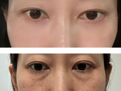 셀카후기 사진