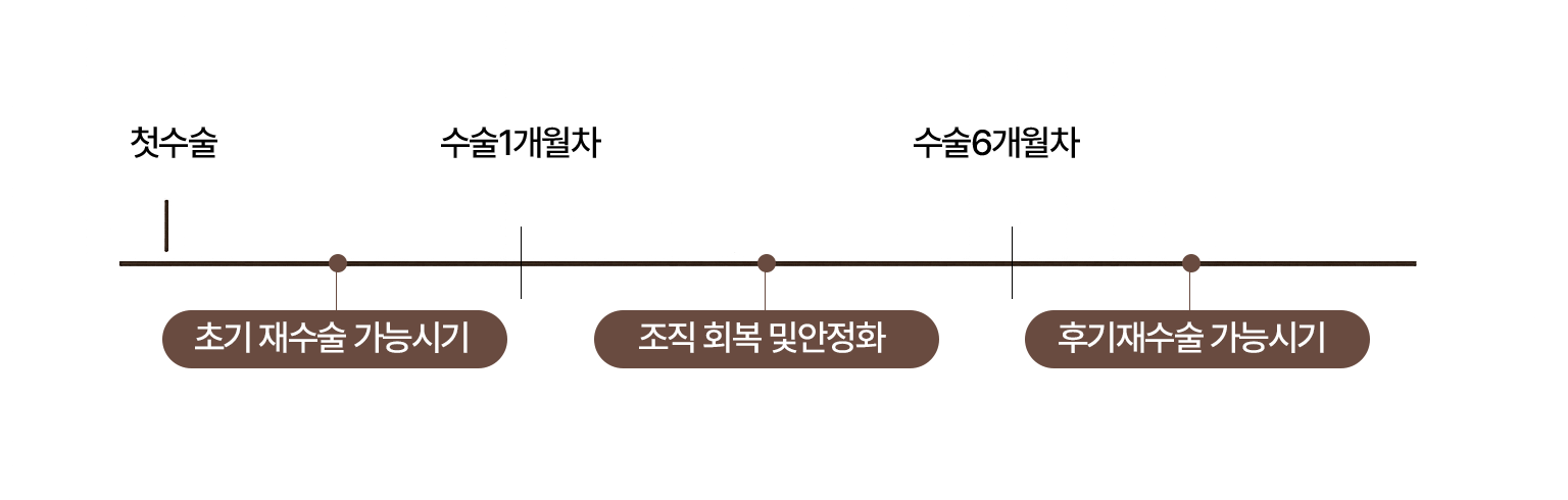 눈재수술 시기 안내